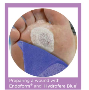 Hydrofera Blue-opatrunek PVA z pigmentami, sterylny, Rozm. 10cm x 10cm-10szt.