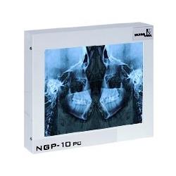 Negatoskop dentystyczny, ekran 24x30 cm CEFALOM 01