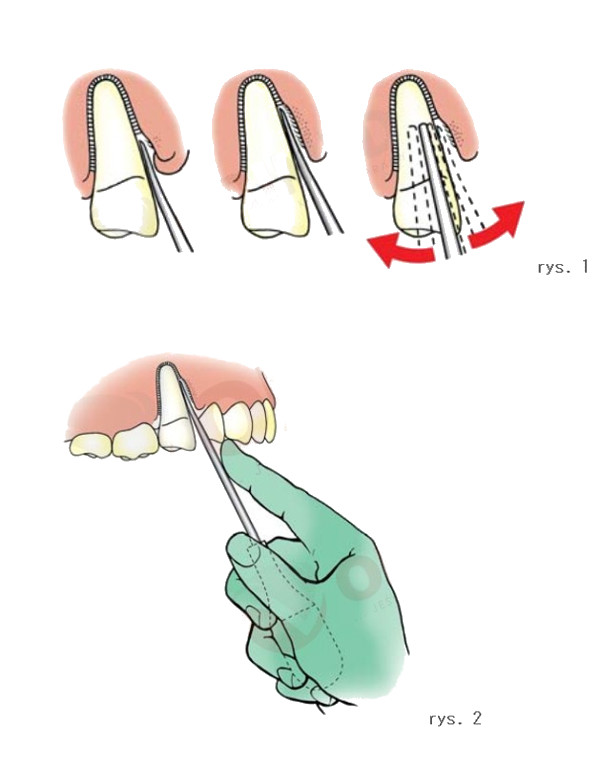 Narzędzia luksujące zestaw 10 szt. + 3 szt. dźwigni GRATIS!