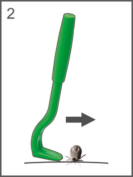 Kleszczołapki - 2 szt.